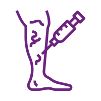 escleroterapia