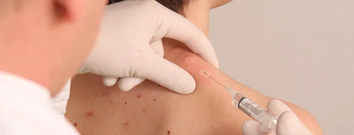 Terapia Neural